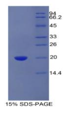 SDS-PAGE (PROCR-589H).jpg